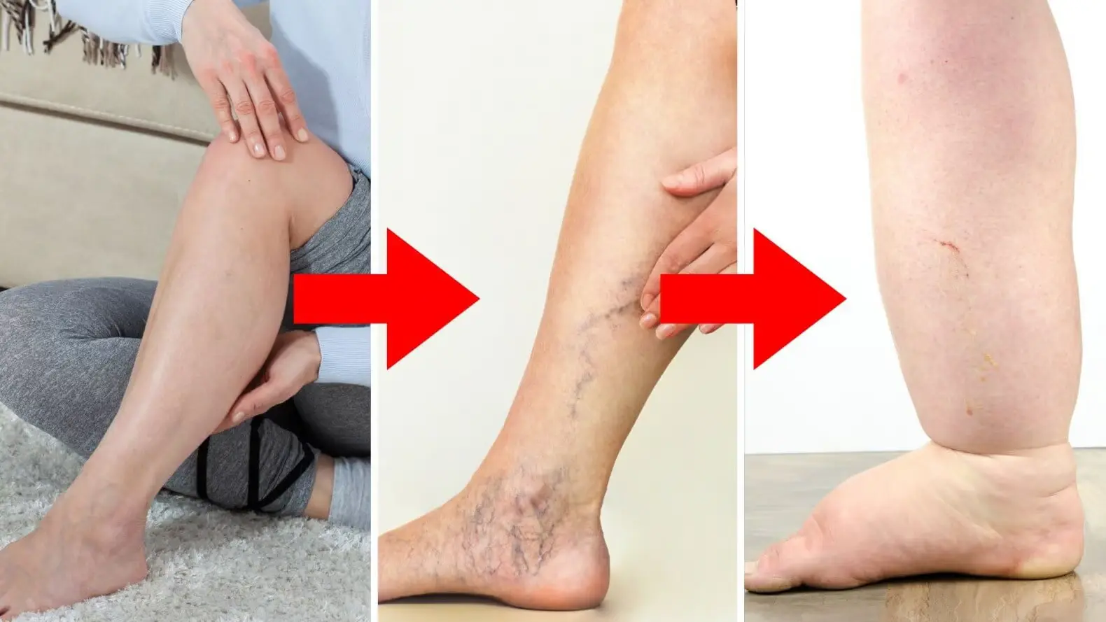 Applying body oil to the legs before rolling