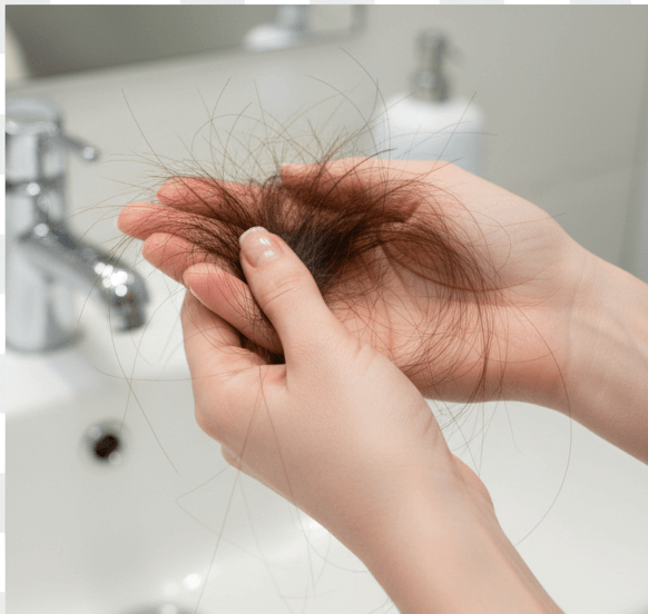 Early Shedding